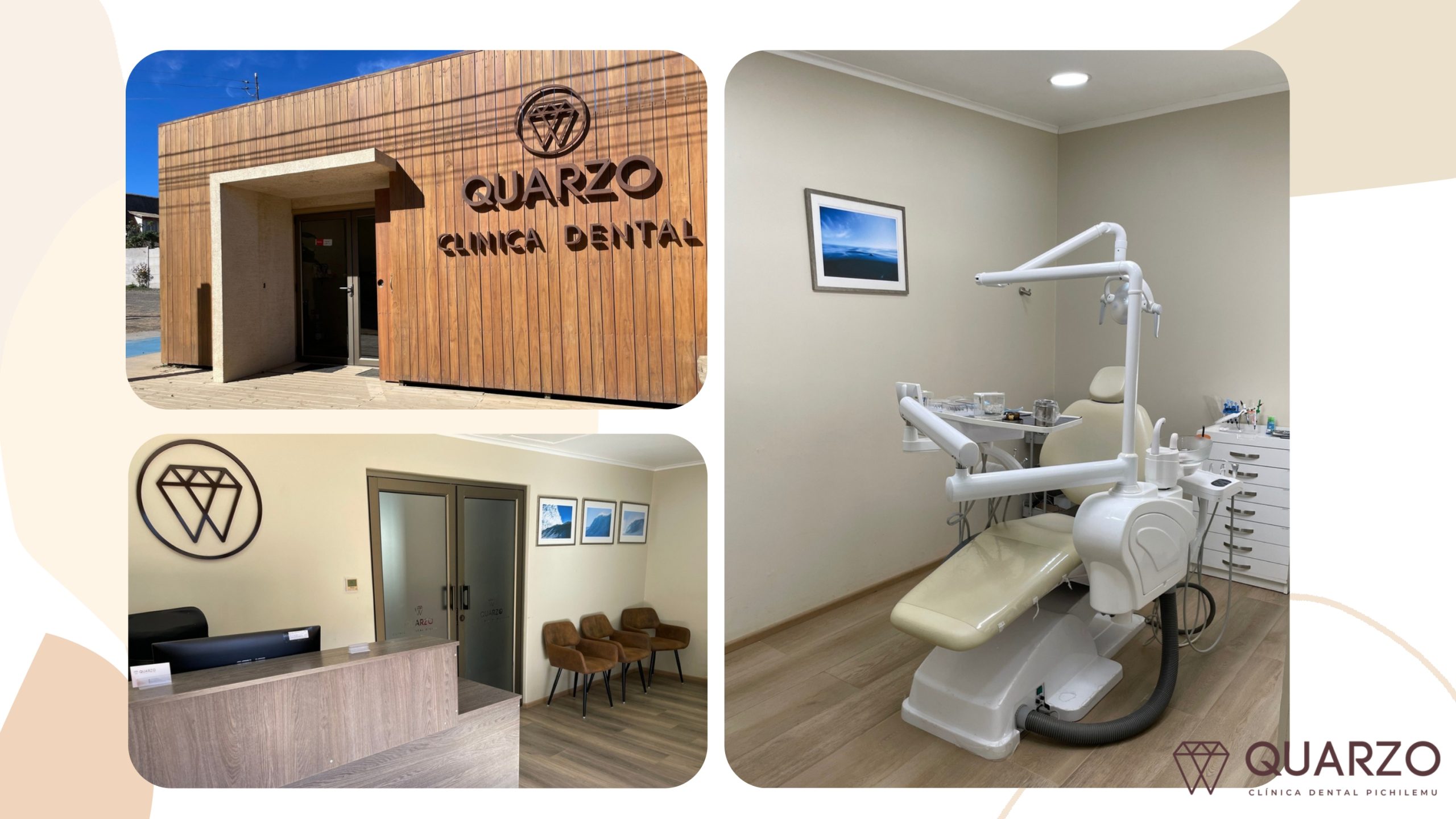 beneficios Quarzo Clínica Dental (3)_page-0006