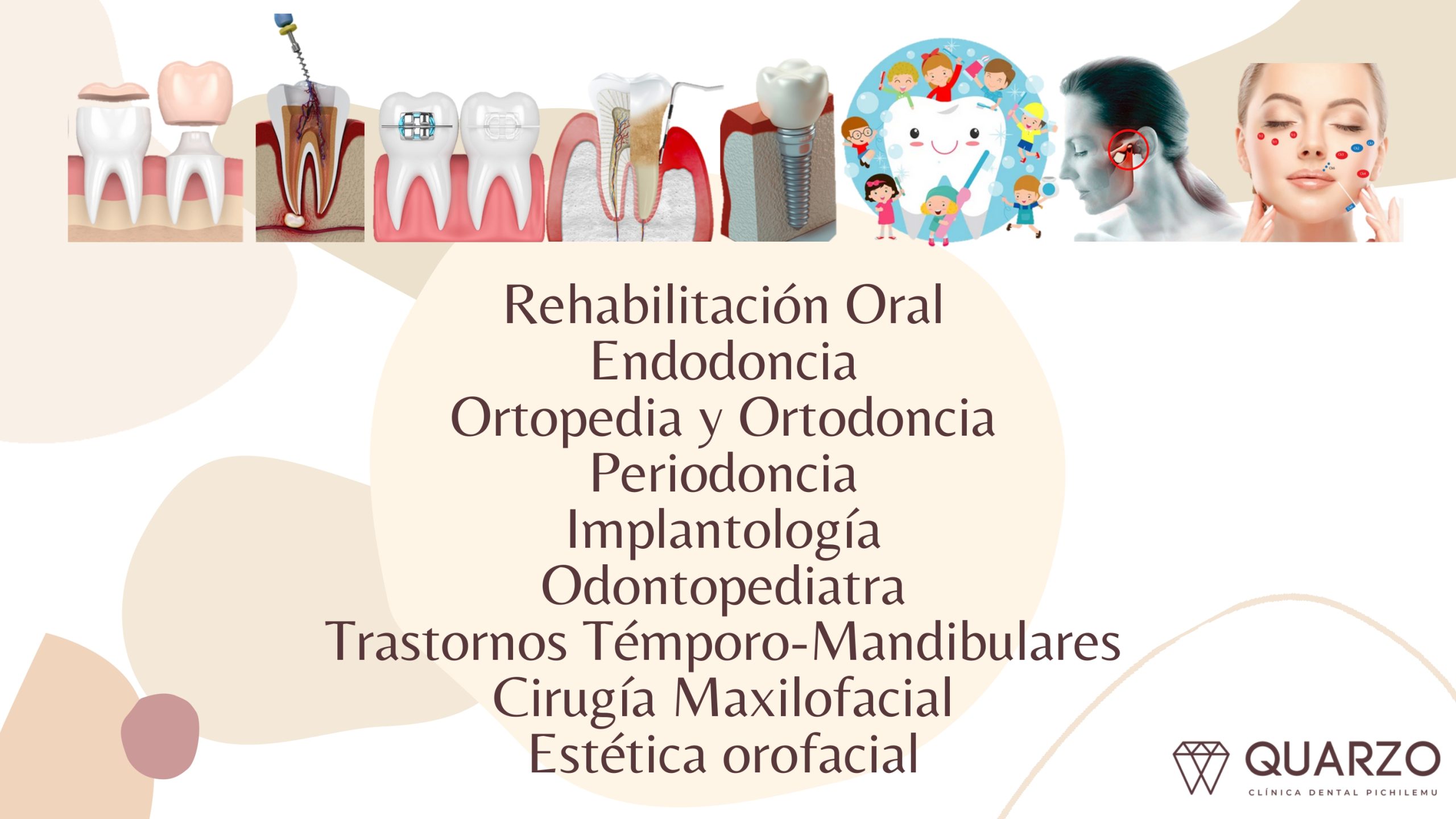 beneficios Quarzo Clínica Dental (3)_page-0008