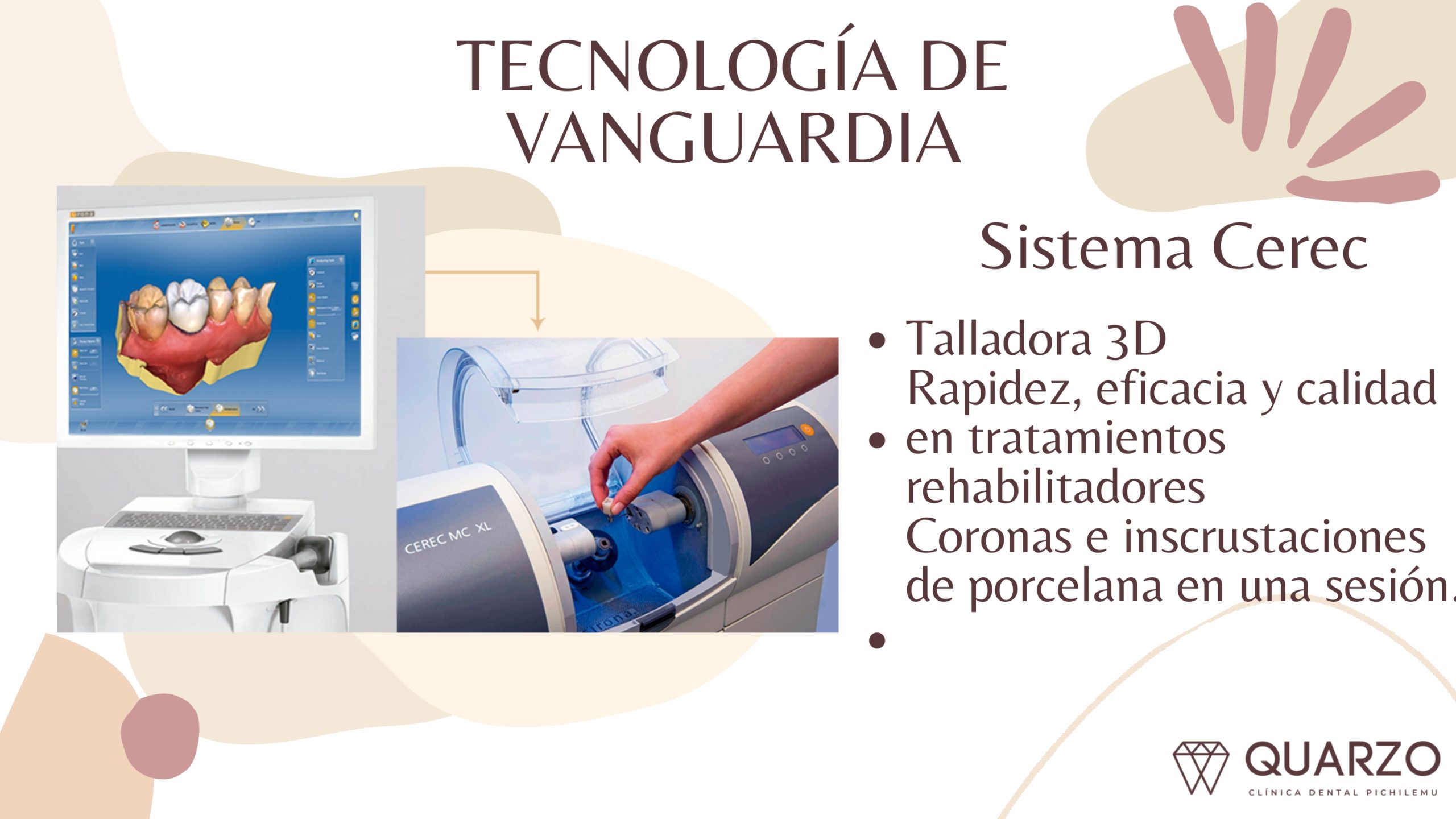 beneficios Quarzo Clínica Dental (3)_page-0010